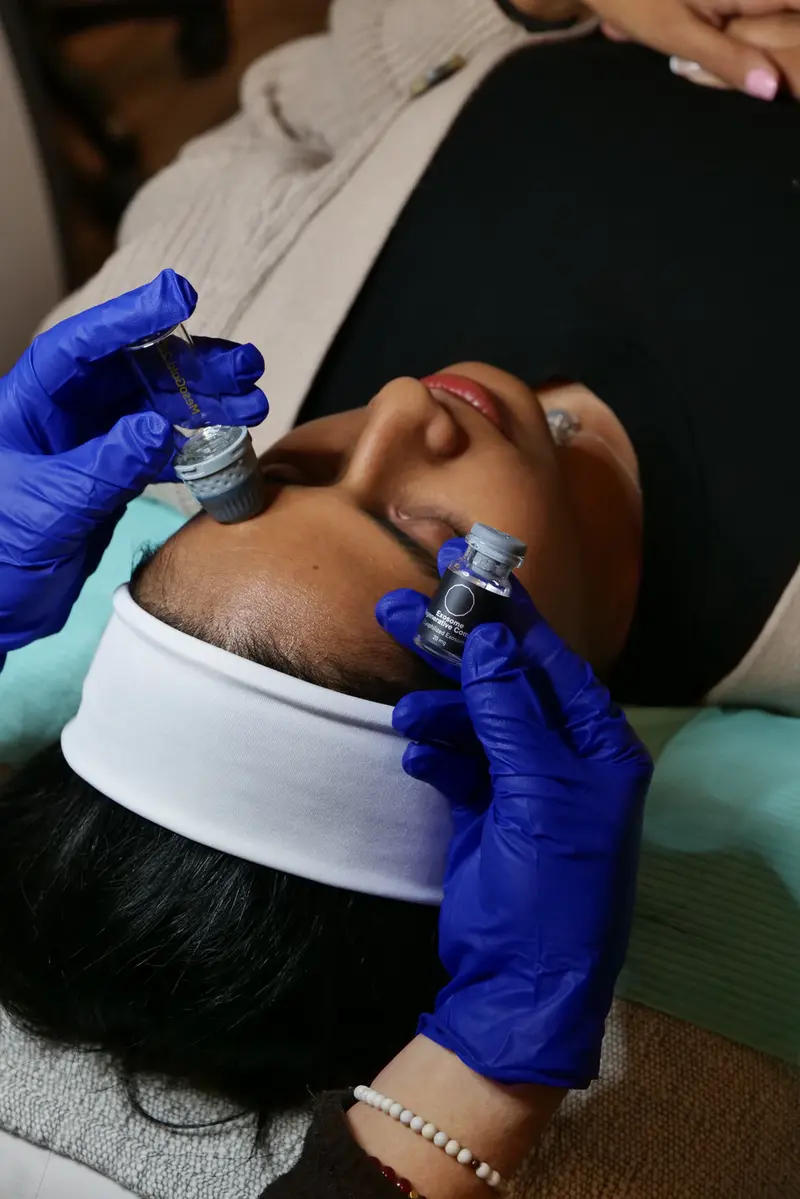 microneedling